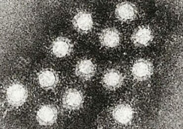 Disease: Hepatitis A flare-up spreading in NH has already claimed a life